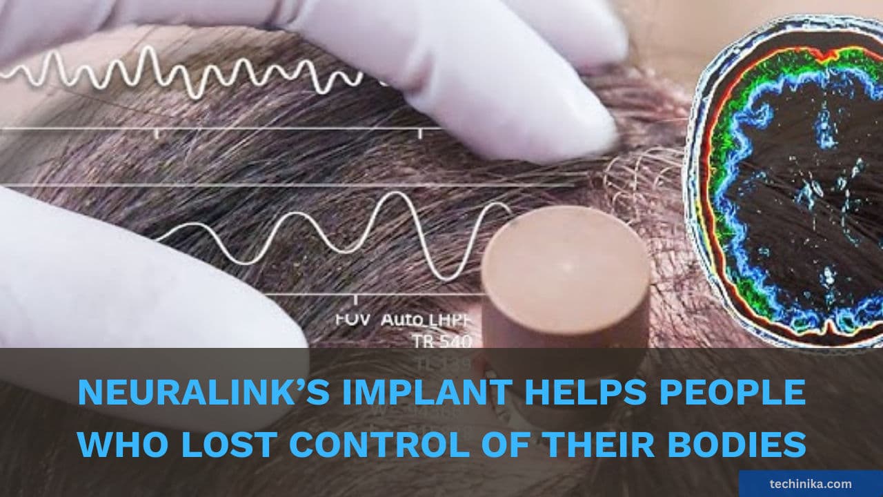 How Neuralink’s Telepathy Implant Is Helping People Who Lost Control of Their Bodies